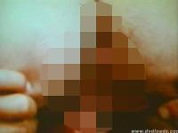 Analgeile Teenager